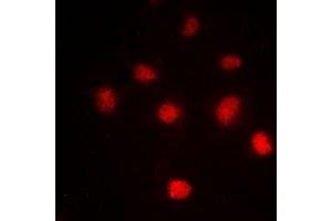 Immunofluorescent analysis of Histone H4 (AcK5) staining in HeLa cells. (Histone H4 anticorps  (acLys5, N-Term))