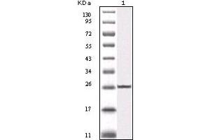 Western blot analysis using IKBKB mouse mAb against truncated IKBKB recombinant protein (1). (IKBKB anticorps)
