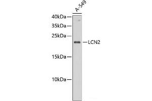 Western blot analysis of extracts of A-549 cells using LCN2 Polyclonal Antibody at dilution of 1:1000. (Lipocalin 2 anticorps)