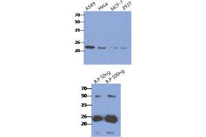 Fig. (CRADD anticorps)