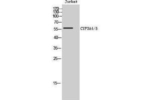 Western Blotting (WB) image for anti-Cytochrome P450, Family 3, Subfamily A, Polypeptide 4/5 (CYP3A4) (Internal Region) antibody (ABIN6282328) (CYP3A4 anticorps  (Internal Region))