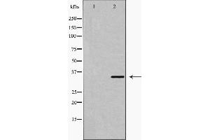 Western blot analysis of Fra 2 expression in LOVO cell extract. (FOSL2 anticorps  (C-Term))