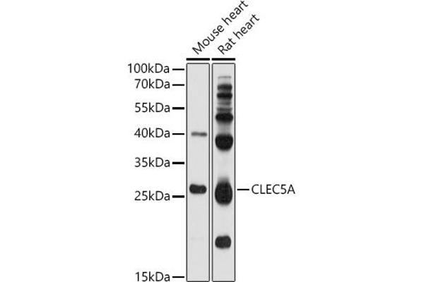 CLEC5A anticorps  (AA 29-188)