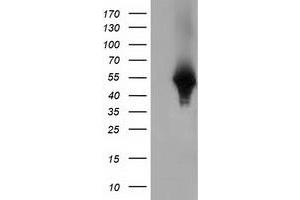 HEK293T cells were transfected with the pCMV6-ENTRY control (Left lane) or pCMV6-ENTRY HP (Right lane) cDNA for 48 hrs and lysed. (Haptoglobin anticorps)