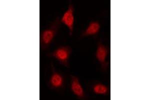 ABIN6267419 staining HT29 by IF/ICC. (AFT1 anticorps  (pSer63))