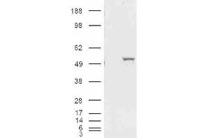HEK293 overexpressing ALDH1A1 and probed with ABIN2561029 (mock transfection in first lane). (ALDH1A1 anticorps  (Internal Region))