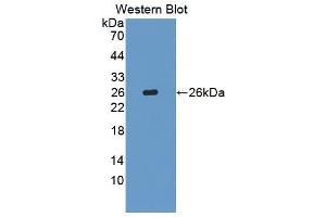 Western blot analysis of recombinant Human BLVRB. (BLVRB anticorps  (AA 2-206))