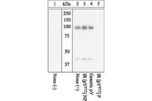 Image no. 1 for anti-Insulin Receptor (INSR) (pTyr972) antibody (ABIN1495716) (Insulin Receptor anticorps  (pTyr972))