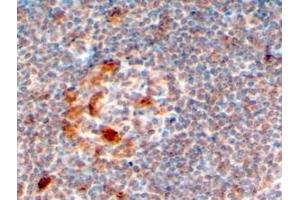 Immunohistochemistry (IHC) image for anti-Zinc Finger, CCHC Domain Containing 11 (ZCCHC11) (C-Term) antibody (ABIN2466463) (ZCCHC11 anticorps  (C-Term))