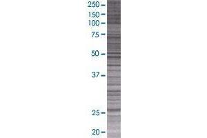 CT45A3 transfected lysate. (CT45A3 293T Cell Transient Overexpression Lysate(Denatured))