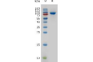 Human TFRC Protein, His Tag on SDS-PAGE under reducing condition. (Transferrin Receptor Protein (AA 89-760) (His tag))