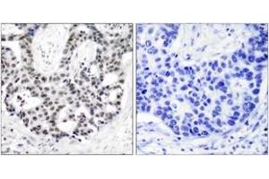 Immunohistochemistry (IHC) image for anti-Androgen Receptor (AR) (pSer650) antibody (ABIN2888357) (Androgen Receptor anticorps  (pSer650))