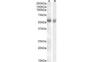 ABIN570926 (0. (TMPRSS2 anticorps  (Internal Region))