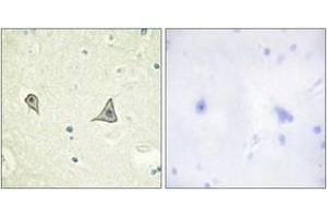 Immunohistochemistry (IHC) image for anti-Colony Stimulating Factor 1 Receptor (CSF1R) (AA 691-740) antibody (ABIN2888738) (CSF1R anticorps  (AA 691-740))