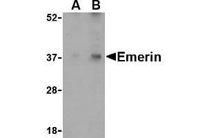 Western blot analysis of Emerin in human skeletal muscle tissue lysate with Emerin antibody at (A) 0. (Emerin anticorps  (N-Term))