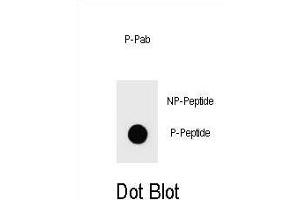 Dot blot analysis of Phospho-PTEN- Antibody Phospho-specific Pab i on nitrocellulose membrane. (PTEN anticorps  (pTyr240))