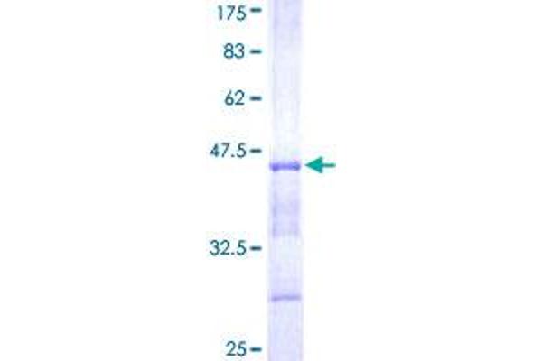 USP4 Protein (AA 676-773) (GST tag)