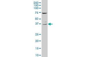 CD68 polyclonal antibody (A01), Lot # 060717JCS1. (CD68 anticorps  (AA 164-262))