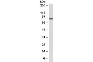 Western blot testing of A549 lysate with FGFR1 antibody at 1ug/ml. (FGFR1 anticorps)