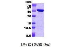 Figure annotation denotes ug of protein loaded and % gel used. (CAB39L Protéine)