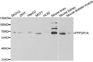 Western blot analysis of extracts of various cell lines, using PPP2R1A antibody (ABIN5973416) at 1/1000 dilution. (PPP2R1A anticorps)