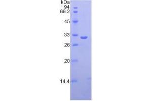 SDS-PAGE analysis of Human Ficolin 3 Protein. (FCN3 Protéine)