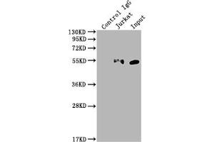 Western Blotting (WB) image for anti-Kruppel-Like Factor 4 (Gut) (KLF4) antibody (ABIN7127591)