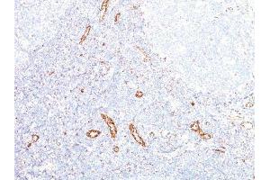 Image no. 1 for anti-Vascular Endothelial Growth Factor A (VEGFA) antibody (ABIN6168158) (VEGFA anticorps)