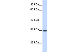 WB Suggested Anti-ATF5 Antibody Titration: 0. (ATF5 anticorps  (Middle Region))
