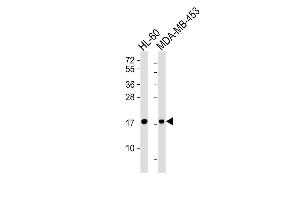 Lane 1: HL-60 Cell lysates, Lane 2: MDA-MB-453 Cell lysates, probed with FHIT (1093CT23. (FHIT anticorps)