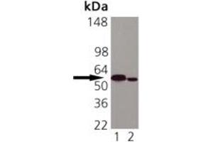 Western blot analysis of Calreticulin: Lane 1: HeLa (Heat Shocked), Lane 2: Vero. (Calreticulin anticorps)