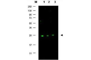 Image no. 1 for anti-P27 antibody (ABIN636752) (P27 anticorps)