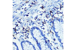 Immunohistochemistry of paraffin-embedded human colon using CD3H Rabbit mAb (ABIN7266174) at dilution of 1:100 (40x lens). (CD247 anticorps)