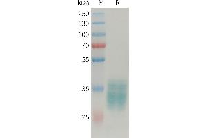 Human APLN Protein, hFc Tag on SDS-PAGE under reducing condition. (Apelin Protein (APLN) (AA 23-77) (Fc Tag))