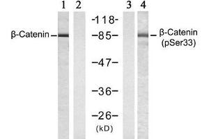 Western blot analysis of extracts from SW 626 cells , untreated or treated with Calyculin A (50nM, 30min), using β-Catenin (Ab-33) antibody (E021211, Lane 1 and 2) and β-Catenin (phospho-Ser33) antibody (E011218, Lane 3 and 4). (beta Catenin anticorps)