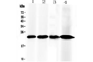 Western blot analysis of RBP4 using anti-RBP4 antibody . (RBP4 anticorps  (AA 19-201))