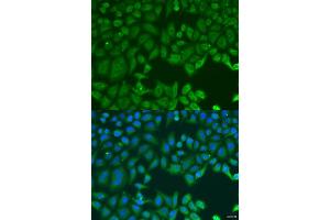 Immunofluorescence analysis of U2OS cells using MAP2K3 antibody (ABIN2737130) at dilution of 1:100. (MAP2K3 anticorps)