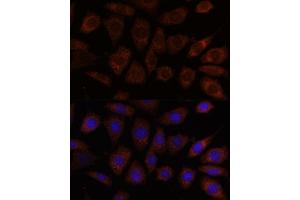 Immunofluorescence analysis of L929 cells using SEC24D antibody (ABIN7270171) at dilution of 1:100. (SEC24D anticorps  (AA 830-1000))