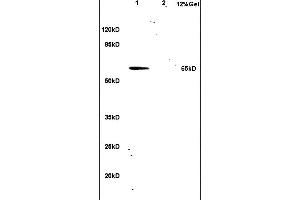 L1 rat lung lysates L2 human colon carcinoma lysates probed with Anti hnRNP L Polyclonal Antibody, Unconjugated (ABIN706631) at 1:200 in 4 °C. (HNRNPL anticorps  (AA 501-589))