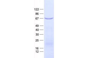 Validation with Western Blot (P4HA3 Protein (His tag))