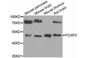 Western blot analysis of extracts of various cell lines, using FOXP3 antibody (ABIN5974993) at 1/1000 dilution. (FOXP3 anticorps)