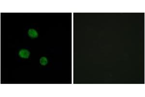 Immunofluorescence analysis of MCF7 cells, using hnRNP M Antibody. (HNRNPM anticorps  (AA 11-60))