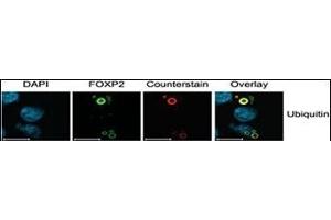 Characterization of FOXP2 Isoforms. (Ubiquitin anticorps  (AA 36-66))