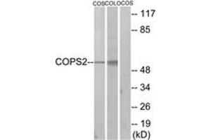 Western blot analysis of extracts from COS7/COLO205 cells, using COPS2 Antibody. (COPS2 anticorps  (AA 181-230))