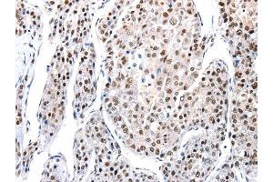 Immunohistochemistry (IHC) image for anti-Aquaporin 2 (Collecting Duct) (AQP2) antibody (ABIN2425579) (AQP2 anticorps)