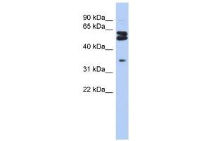 OGFOD1 antibody used at 1 ug/ml to detect target protein. (OGFOD1 anticorps  (Middle Region))