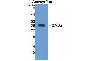 Detection of Recombinant MSRA, Human using Polyclonal Antibody to Methionine Sulfoxide Reductase A (MSRA) (MSRA anticorps  (AA 27-235))