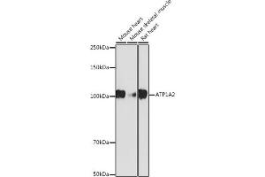 Western blot analysis of extracts of various cell lines, using  antibody (ABIN7265769) at 1:1000 dilution. (ATP1A2 anticorps)