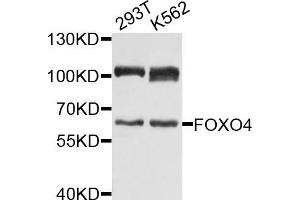 Western blot analysis of extracts of various cell lines, using FOXO4 antibody (ABIN5971698) at 1/1000 dilution. (FOXO4 anticorps)