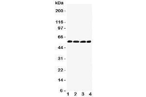 Western blot testing of IRF5 antibody and Lane 1:  human placenta;  2: rat thymus;  3: (r) kidney;  4: (r) ovary tissue lysate. (IRF5 anticorps  (C-Term))